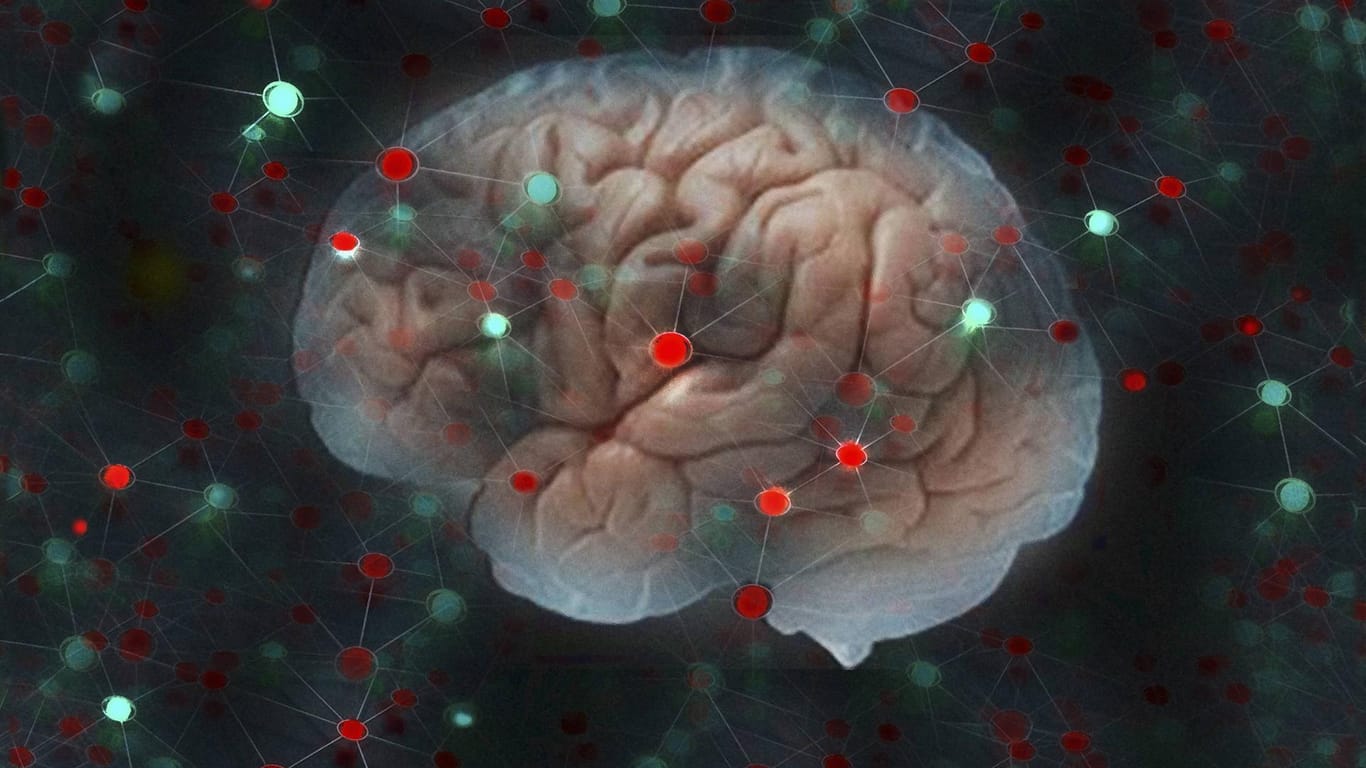 Netzwerk aus Lichtern umgibt ein Gehirn