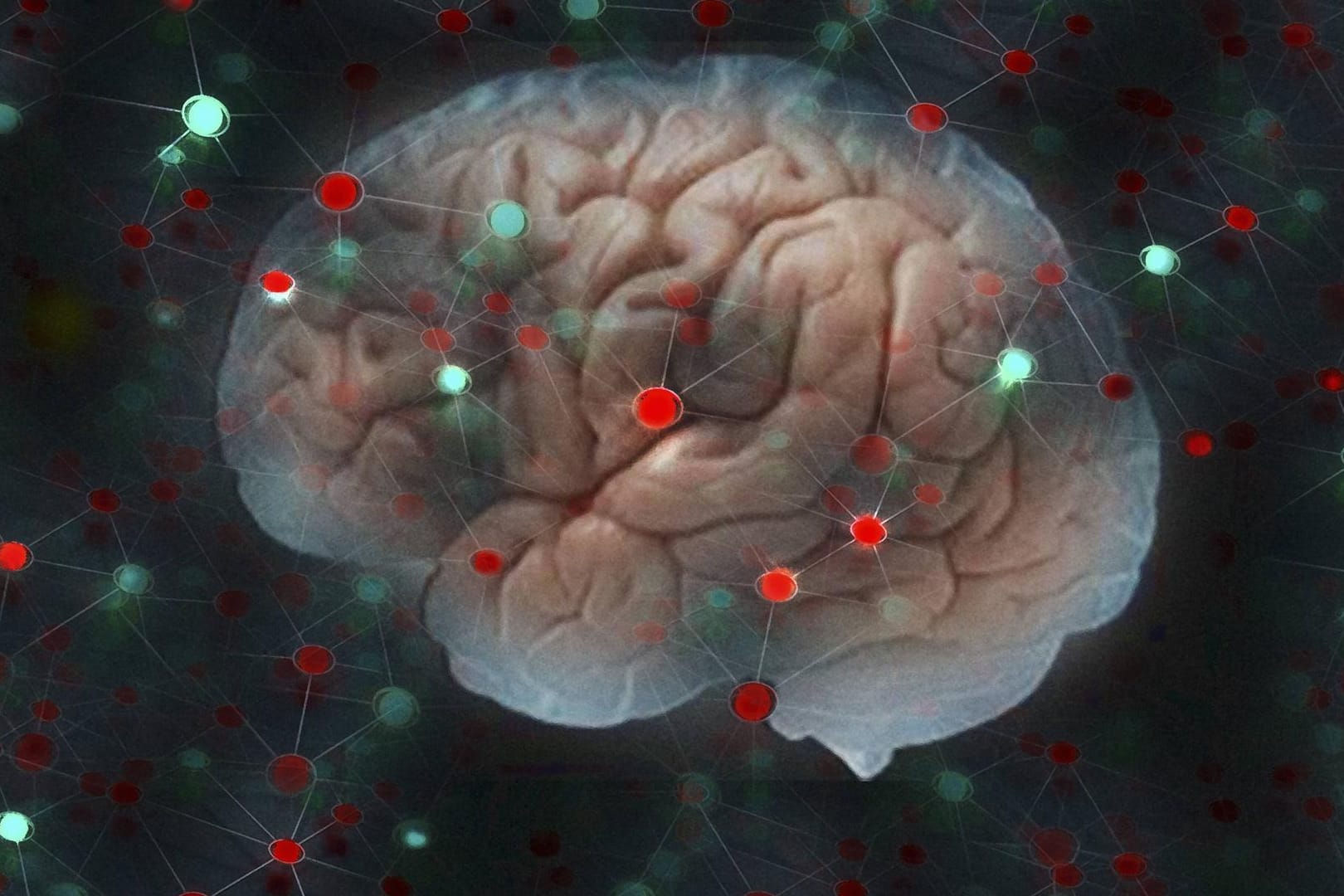 Netzwerk aus Lichtern umgibt ein Gehirn