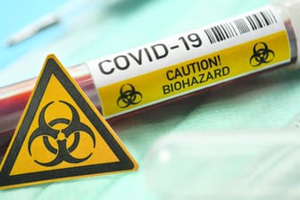 Ein Blutentnahmeröhrchen mit der Aufschrift Covid-19 (Symbolbild): In der Mainzer Unimedizin wird derzeit die erste mit Coronavirus infizierte Patientin behandelt.