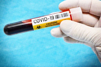 Hand mit Latexhandschuh hält Blutentnahmeröhrchen mit Aufschrift Covid-19: Immer mehr Menschen werden positiv auf das Coronavirus getestet.