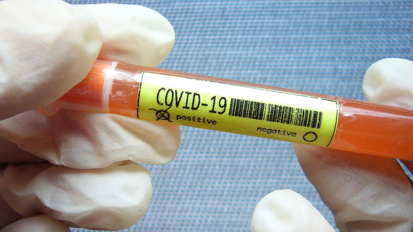 Eine Ampulle, in der das Blut positov auf Corona getestet wurde: Inzwischen gibt es in Hagen einen ersten Coronavirus-Fall (Symbolfoto).