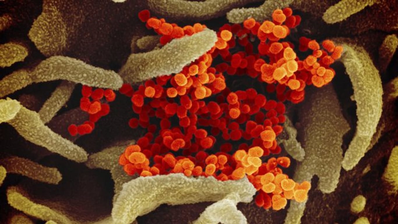Eine elektronenmikroskopische Aufnahme zeigt das Coronavirus (SARS-CoV-2, orange), das aus der Oberfläche von im Labor kultivierten Zellen (grau) austritt.