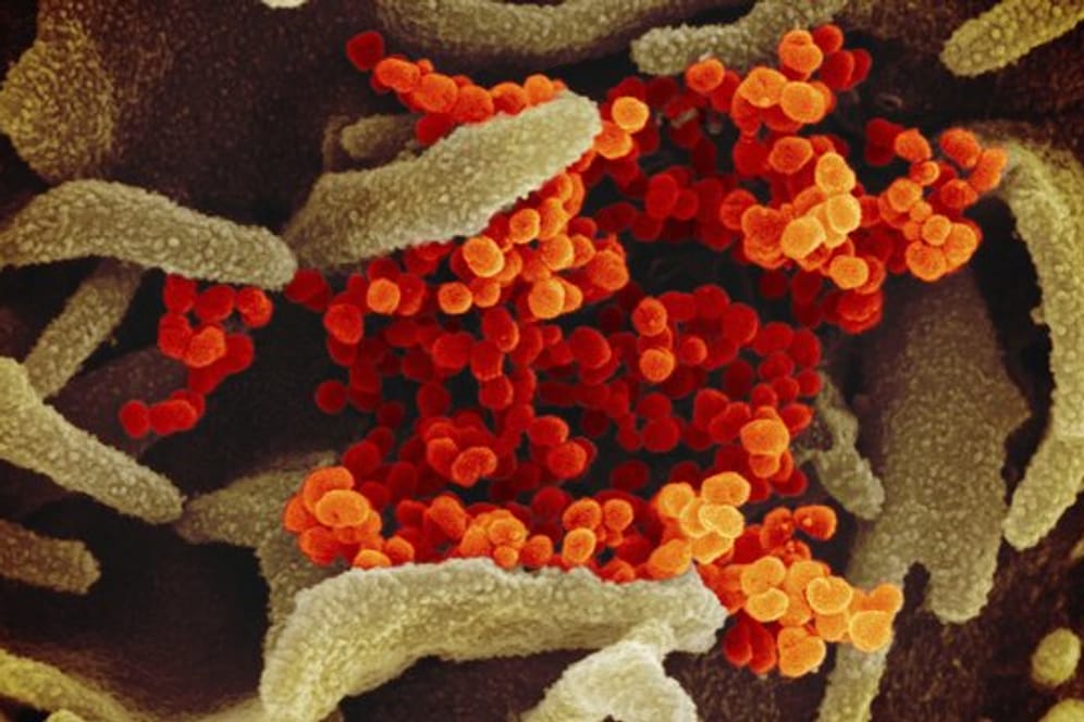 Eine elektronenmikroskopische Aufnahme zeigt das Coronavirus (SARS-CoV-2, orange), das aus der Oberfläche von im Labor kultivierten Zellen (grau) austritt.
