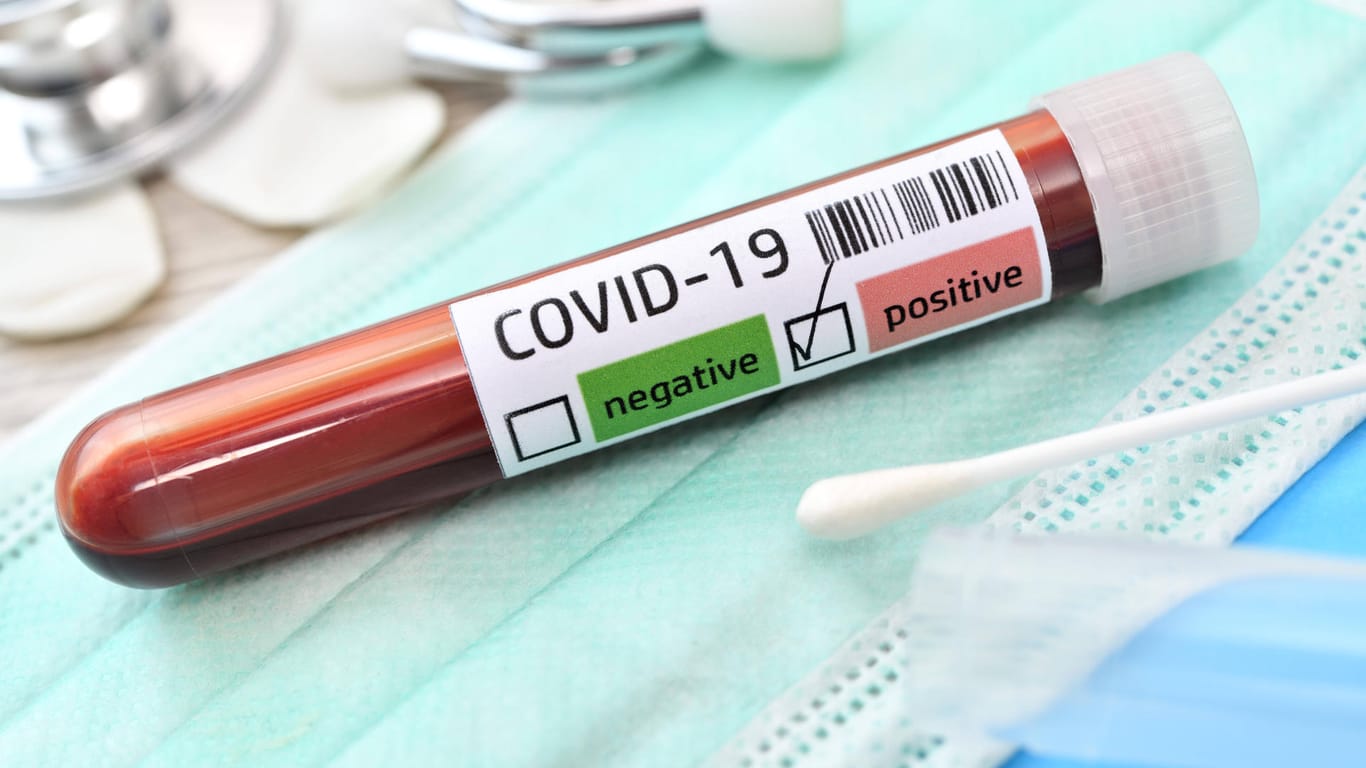 Blutprobe mit positivem Covid-19-Befund: Ein infizierter Mann ist in Hamburg gestorben.
