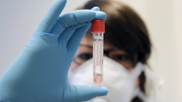 Wer sich auf das Coronavirus testen lassen möchte, muss lange Wartezeiten einplanen.