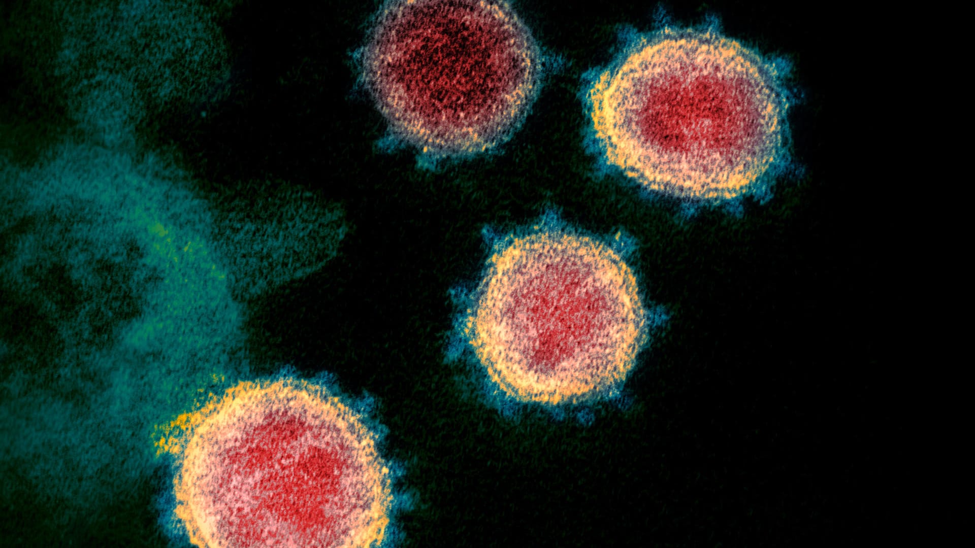 Coronavirus unter dem Elektronenmikroskop.