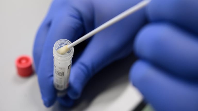 Coronavirus: Experten sind sich einig, dass rigoroses Testen die Epidemie bremsen kann.