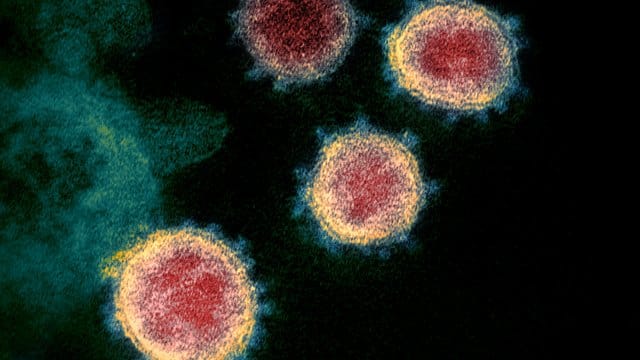Das Virus in einer elektronenmikroskopischen Aufnahme, das Covid-19 verursacht. Das Virus in einer elektronenmikroskopischen Aufnahme, das Covid-19 verursacht.
