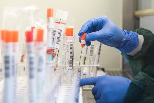 Sondersendungen zum Coronavirus bescheren den öffentlich-rechtlichen Sendern gute Quoten.
