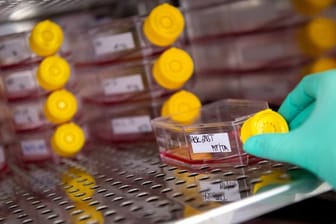 Eine Mitarbeiterin am Institut für Virologie der technischen Universität München (TUM) stellt eine Flasche mit einer Zellkultur in einen Inkubator.
