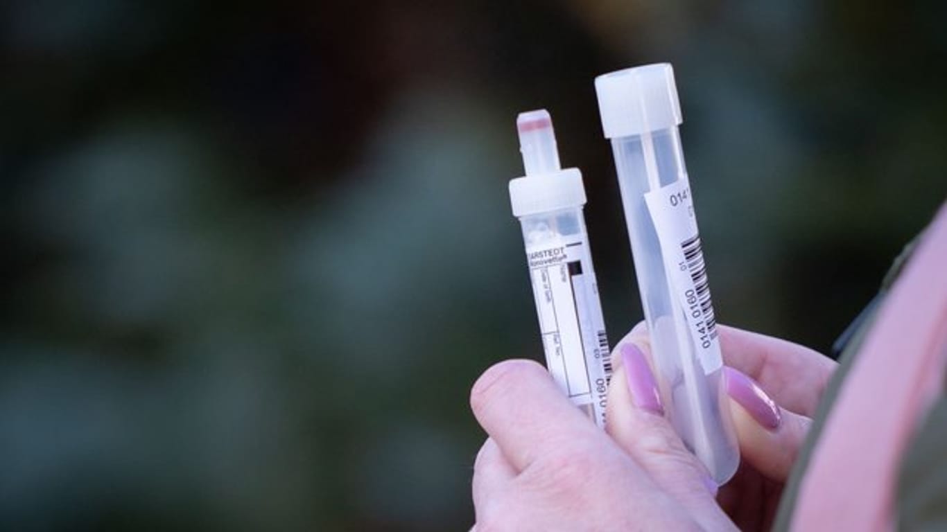 Eine Patientin in Berlin mit zwei Teströhrchen in der Hand für einen Abstrichtest und eine Blutprobe.
