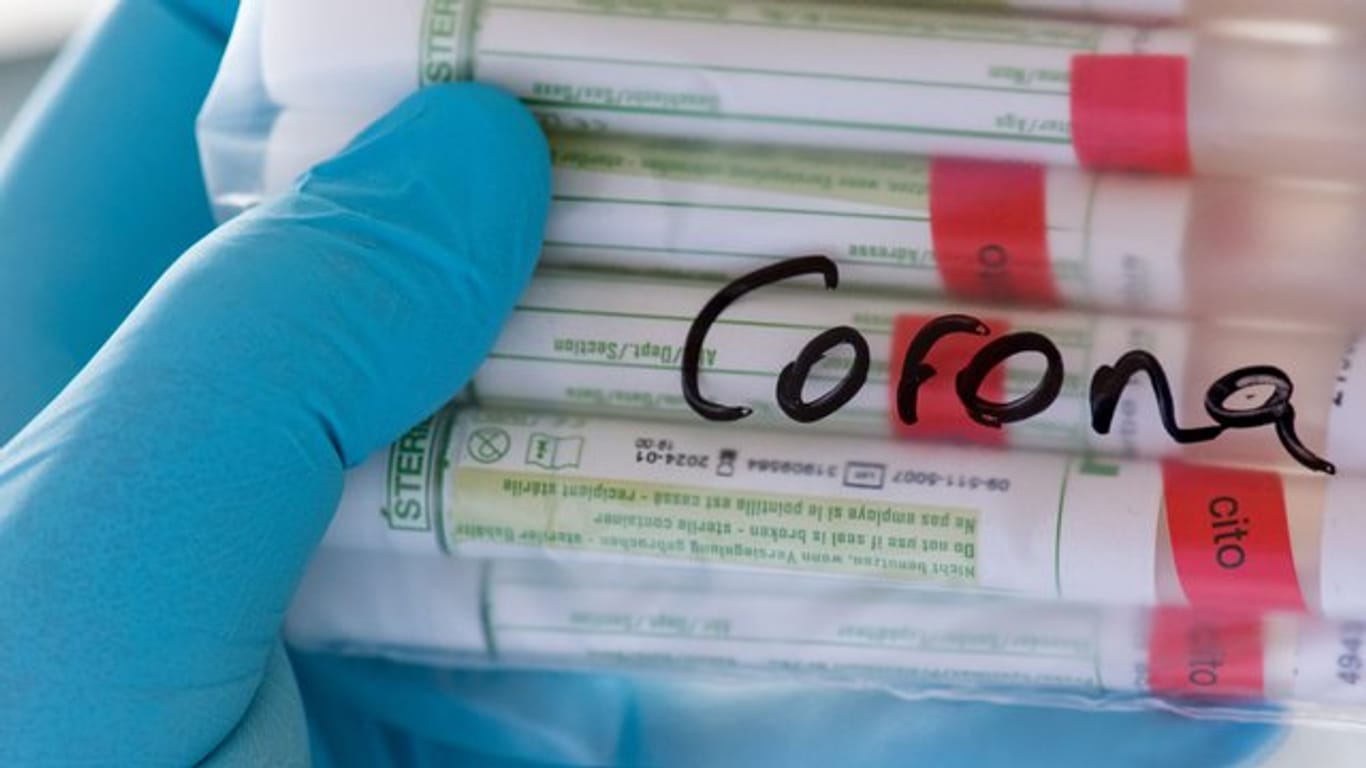 Proben mit Abstrichen werden in einem Labor auf das Coronavirus untersucht.