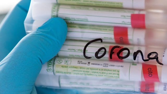Proben für Corona-Tests werden für die weitere Untersuchung vorbereitet. Proben für Corona-Tests werden für die weitere Untersuchung vorbereitet.