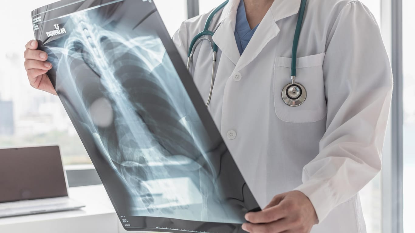 Röntgenbild der Lunge: Es kann über mögliche Schädigungen Aufschluss geben.