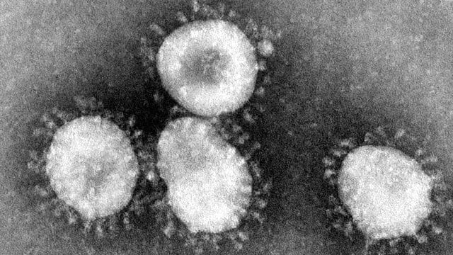 Ein Coronavirus unter dem Mikroskop (Symbolbild): In Bonn haben sich 40 Bewohner einer Flüchtlingsunterkunft mit dem Coronavirus infiziert. Ein Coronavirus unter dem Mikroskop (Symbolbild): In Bonn haben sich 40 Bewohner einer Flüchtlingsunterkunft mit dem Coronavirus infiziert.