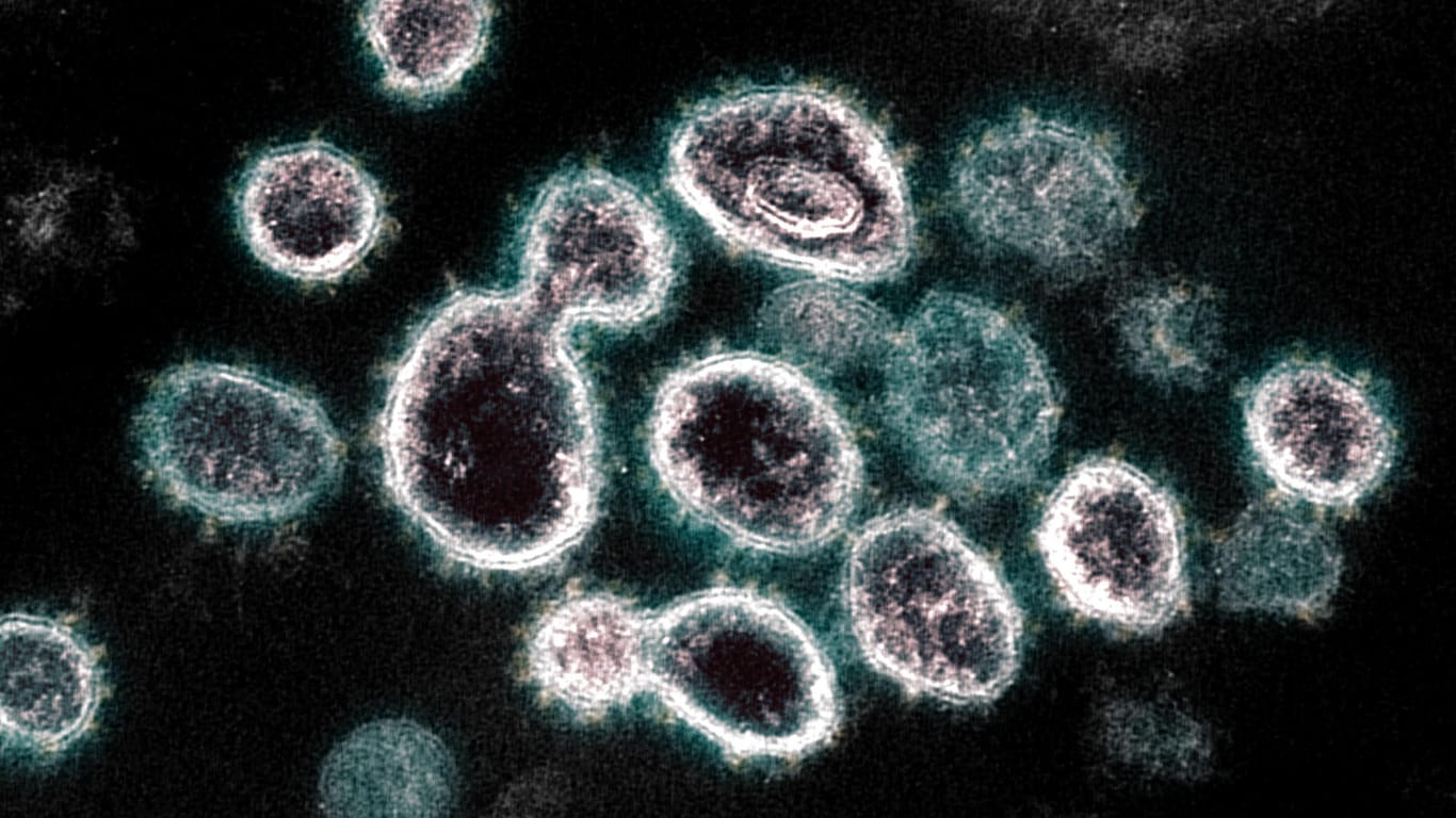 Ein Coronavirus unter dem Mikroskop (Symbolbild): In Düsseldorf haben sich vier Bewohner einer Flüchtlingsunterkunft mit dem Coronavirus infiziert.