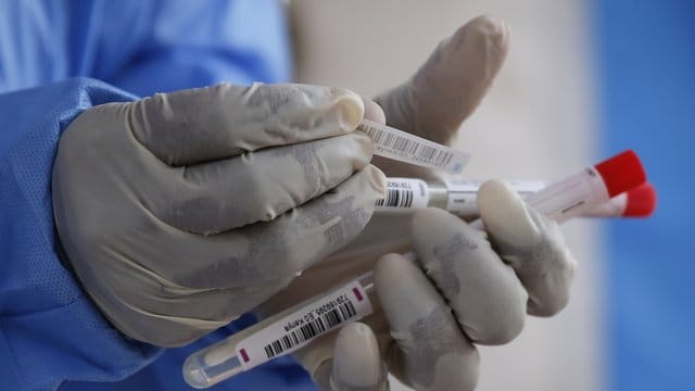 Eine Labortechnikerin bereitet Nasenabstriche für einen Test zur Ermittlung des Coronavirus in einem pathologischem Labor vor. Eine Labortechnikerin bereitet Nasenabstriche für einen Test zur Ermittlung des Coronavirus in einem pathologischem Labor vor.