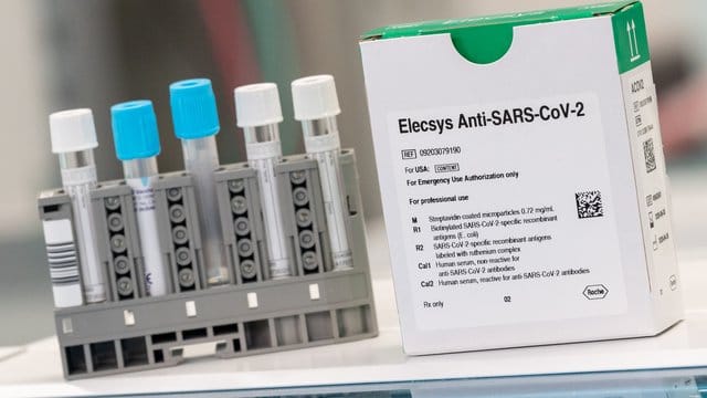 Drei Millionen dieser Tests will Roche noch im Mai zur Verfügung stellen. Drei Millionen dieser Tests will Roche noch im Mai zur Verfügung stellen.