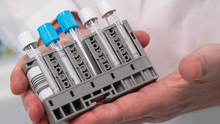 Antikörpertest: Deutschland will Millionen Einheiten des neuen serologischen Tests Elecsys Anti-SARS-CoV-2 von Roche kaufen.