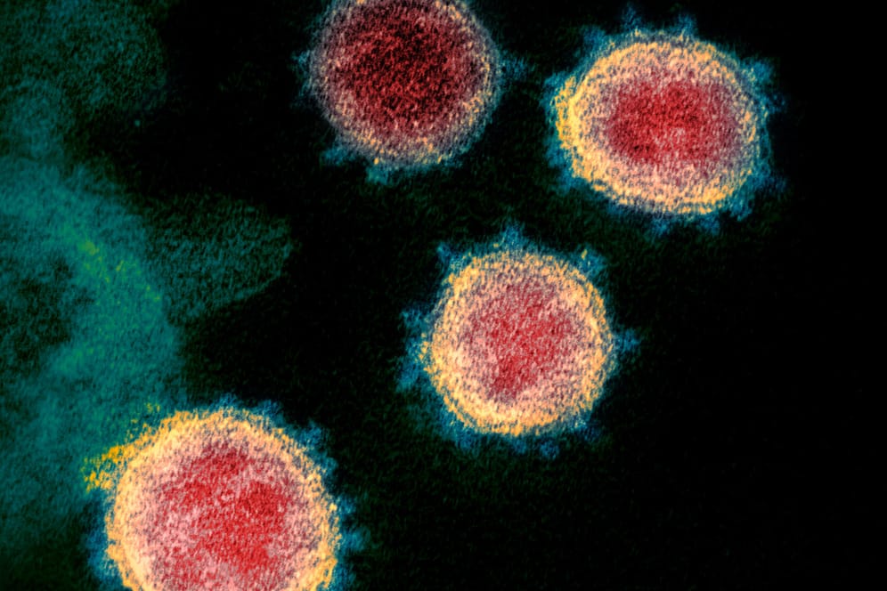 Coronavirus: Die Organismen können im Körper schwere Schäden anrichten, so aucg das SARS-CoV-2, das Covid-19 verursacht.