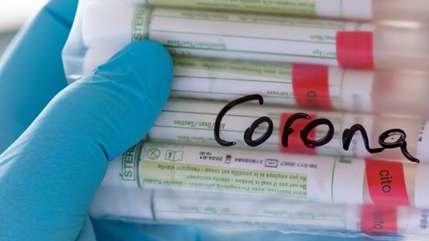Proben für Corona-Tests in einem Diagnose-Labor.