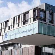 Universitätsklinikum Hamburg-Eppendorf: Eine Studie des Klinikums deutet darauf hin, dass viele Covid-19-Patienten durch eine Embolie sterben.
