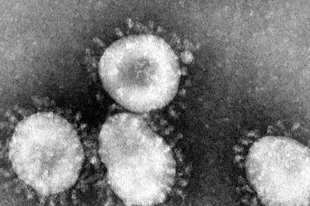 Coronavirus