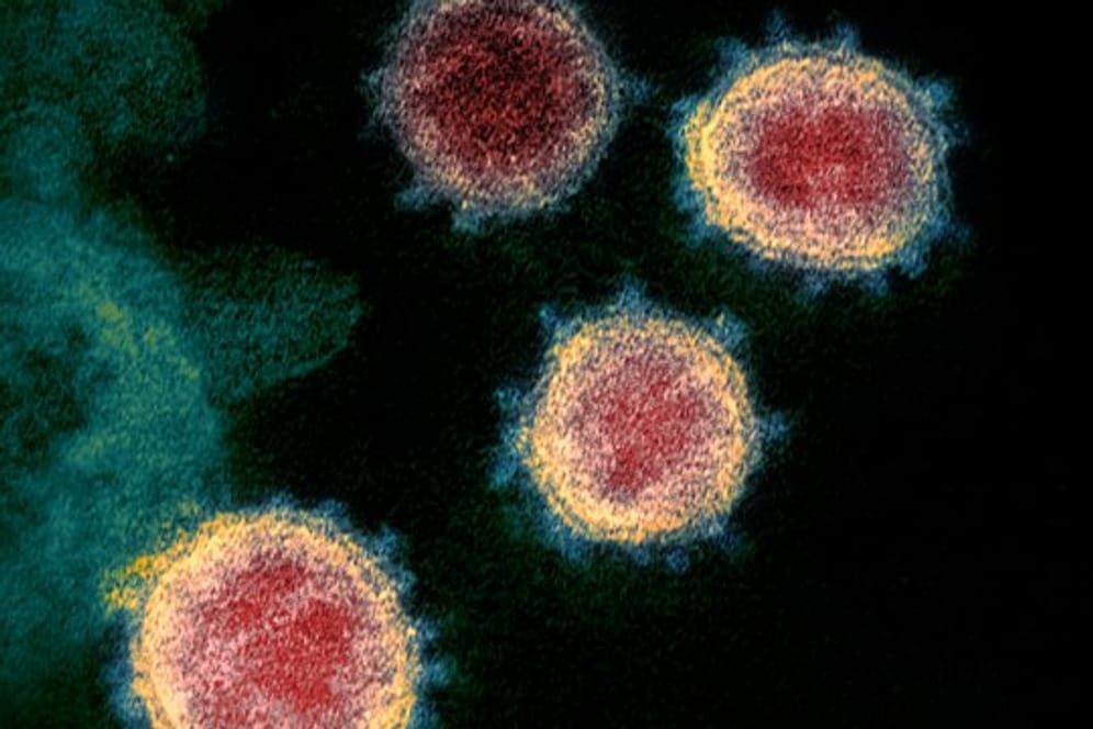 Eine elektronenmikroskopische Aufnahme zeigt das Coronavirus