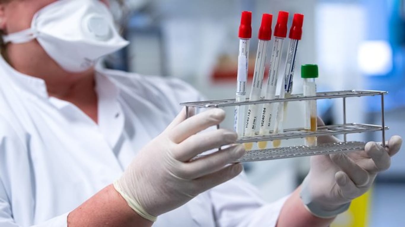 Eine Gesundheitsmitarbeiterin bereitet Tests auf das Coronavirus für die weitere Analyse vor.