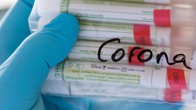 Beschriftete Proben für Corona-Tests