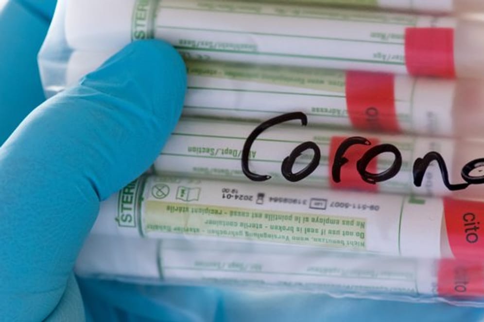 Beschriftete Proben für Corona-Tests