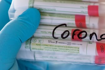 Proben für Corona-Tests werden in der Hand gehalten