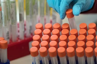 Coronavirus: Vier Monate nach den ersten Corona-Fällen in Deutschland haben Wissenschaftler die Ansteckungsketten der ersten Patientengruppe detailliert analysiert.