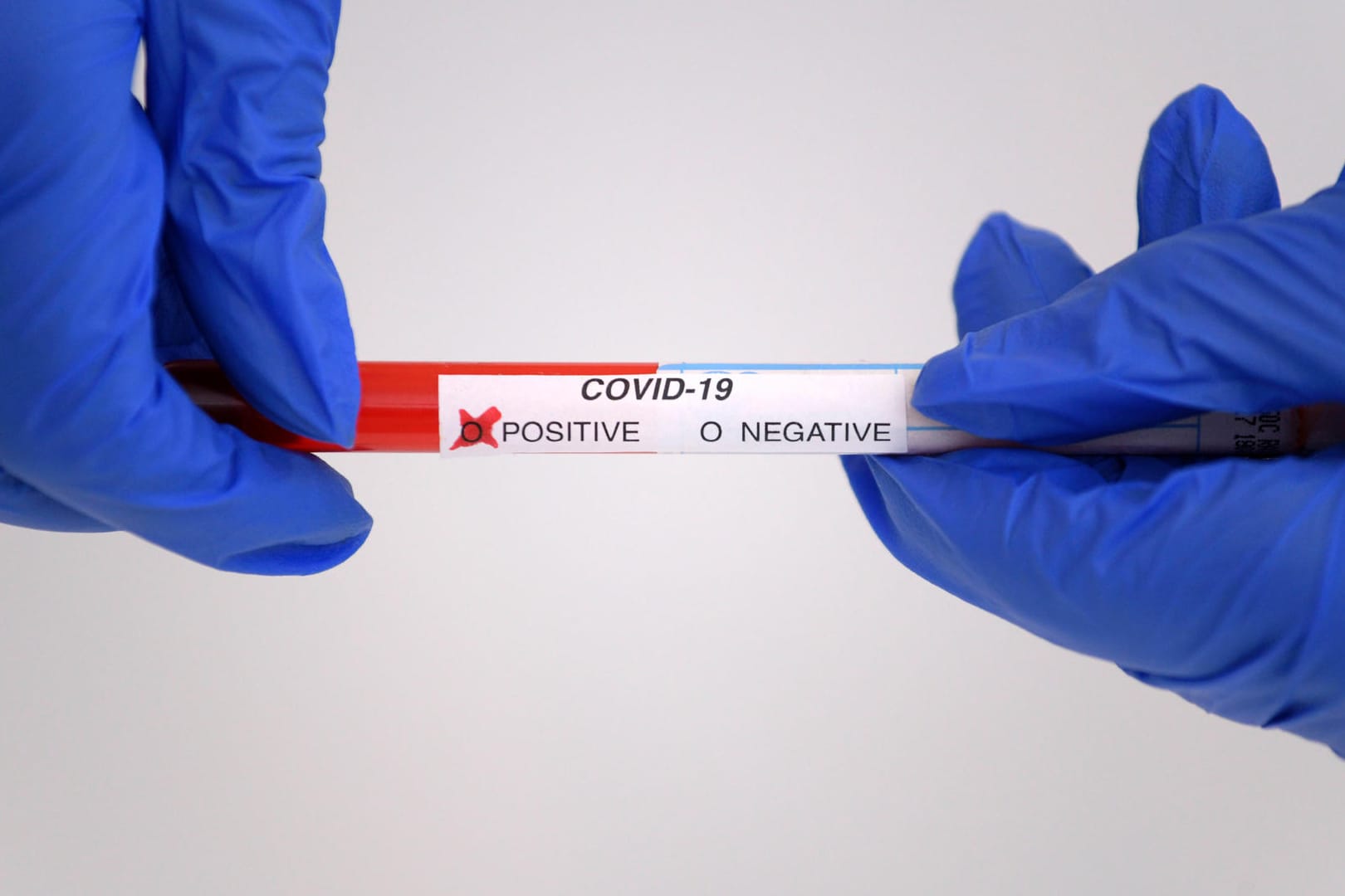 Zwei Hände halten einen positiven Covid-19-Test: In einer Mainzer Flüchtlingsunterkunft haben sich mehrere Menschen mit dem Coronavirus infiziert.