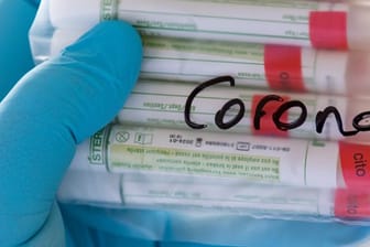 Proben für Corona-Tests werden in einem Labor vorbereitet