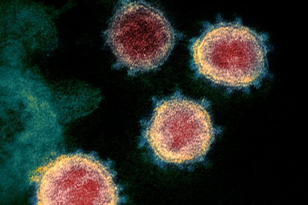 Eine elektronenmikroskopische Aufnahme zeigt das Coronavirus
