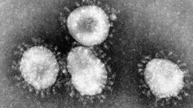 Eine Mikroskopaufnahme zeigt das Coronavirus