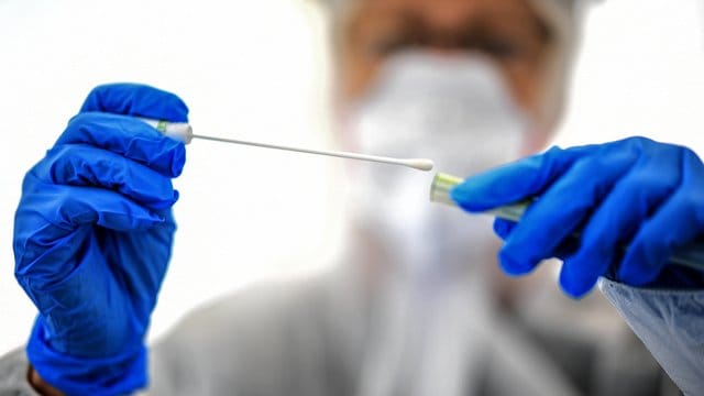 Bisher werden Tests in der Regel nur bei einem konkreten Infektionsverdacht durchgeführt. Bisher werden Tests in der Regel nur bei einem konkreten Infektionsverdacht durchgeführt.
