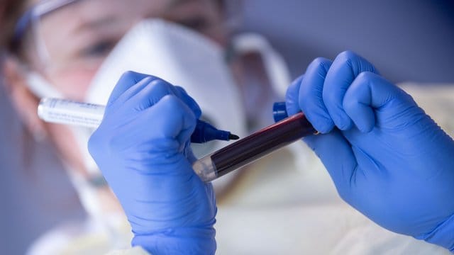 Ein Mitarbeiterin des Robert Koch-Instituts (RKI) beschriftet eine Blutprobe. Ein Mitarbeiterin des Robert Koch-Instituts (RKI) beschriftet eine Blutprobe.