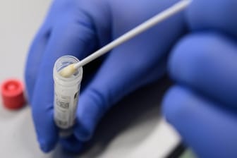 Coronavirus-Test