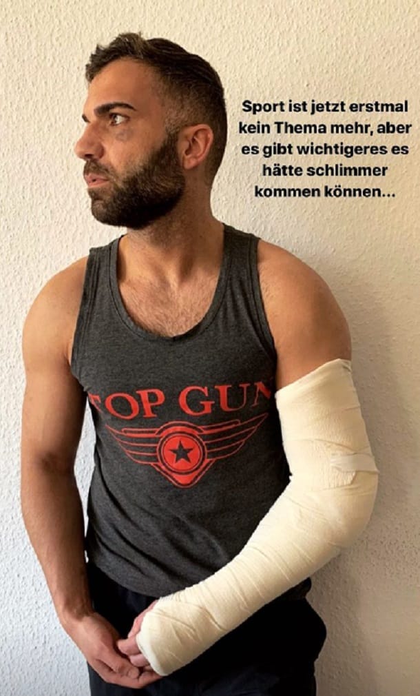 Rafi Rachek: Auf Instagram zeigt er seine Verletzungen.