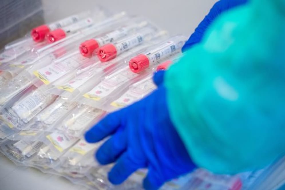 Testsets liegen in einem Testzentrum für Corona-Verdachtsfälle