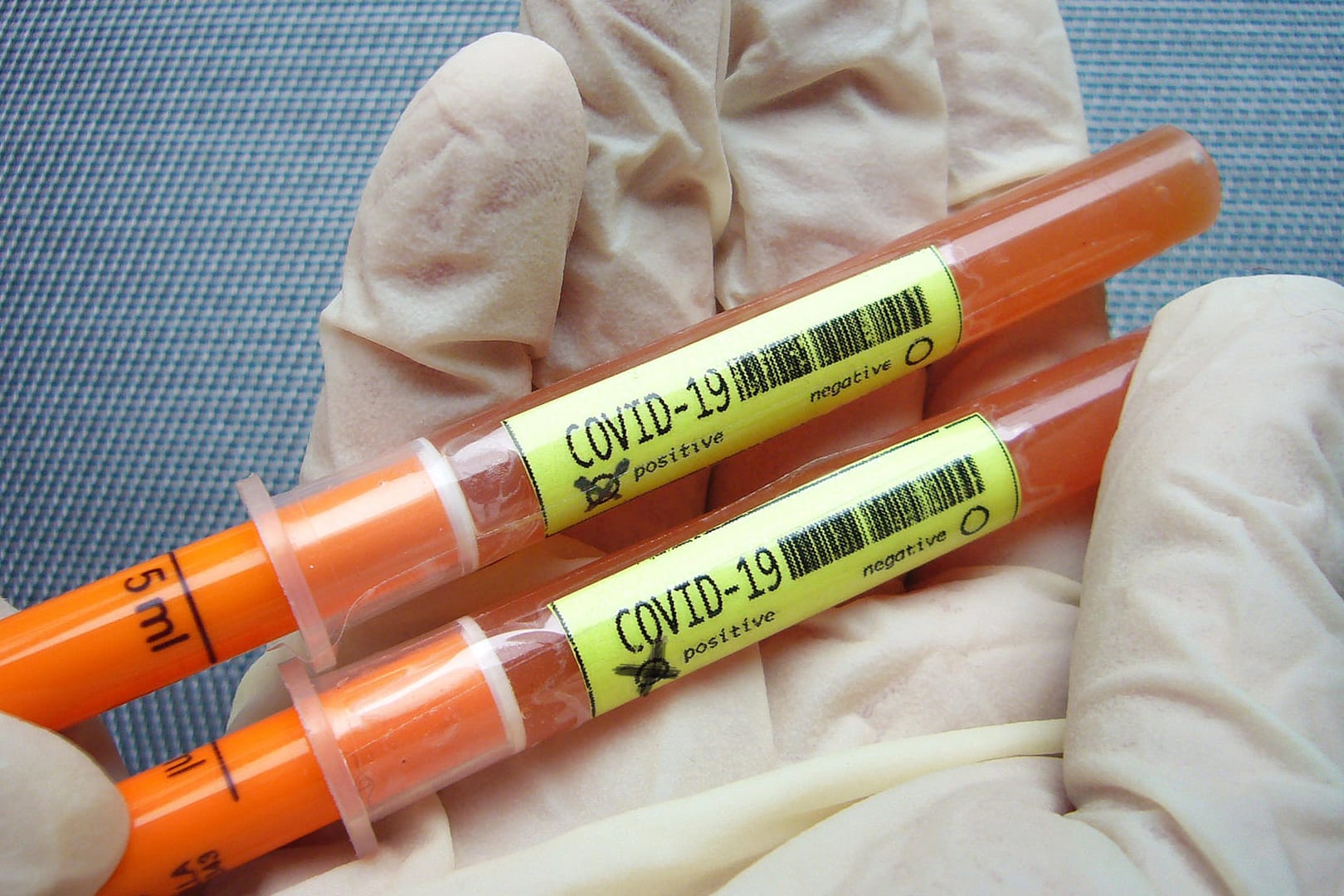 Zwei positive Corona-Tests: Die Reproduktionszahl liegt in Deutschland jetzt deutlich über 1 (Symbolbild).