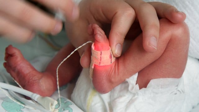 Bei extrem unreif geborenen Kindern bestehen große Risiken.