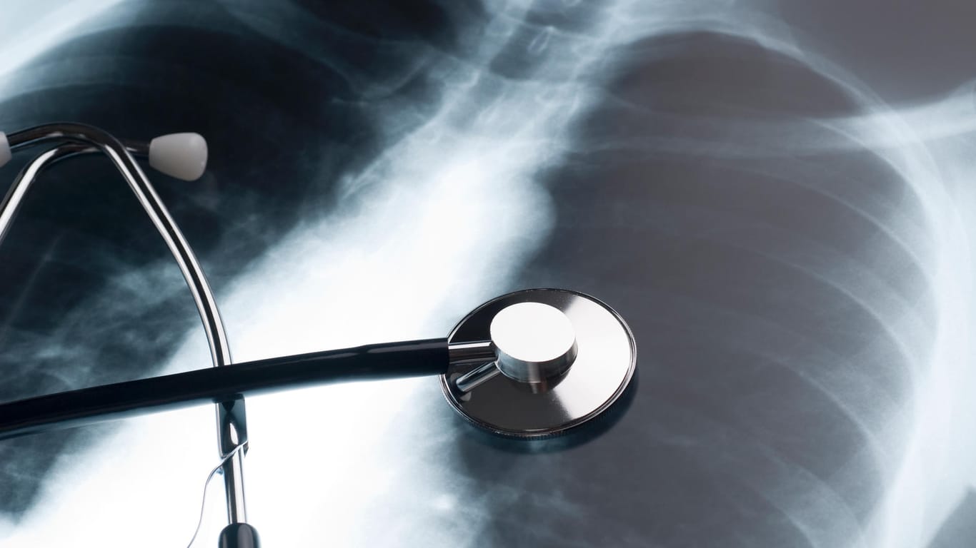 Ein Stethoskop liegt auf einem Röntgenbild: Die meisten Knochentumore werden mithilfe bildgebender Verfahren diagnostiziert.
