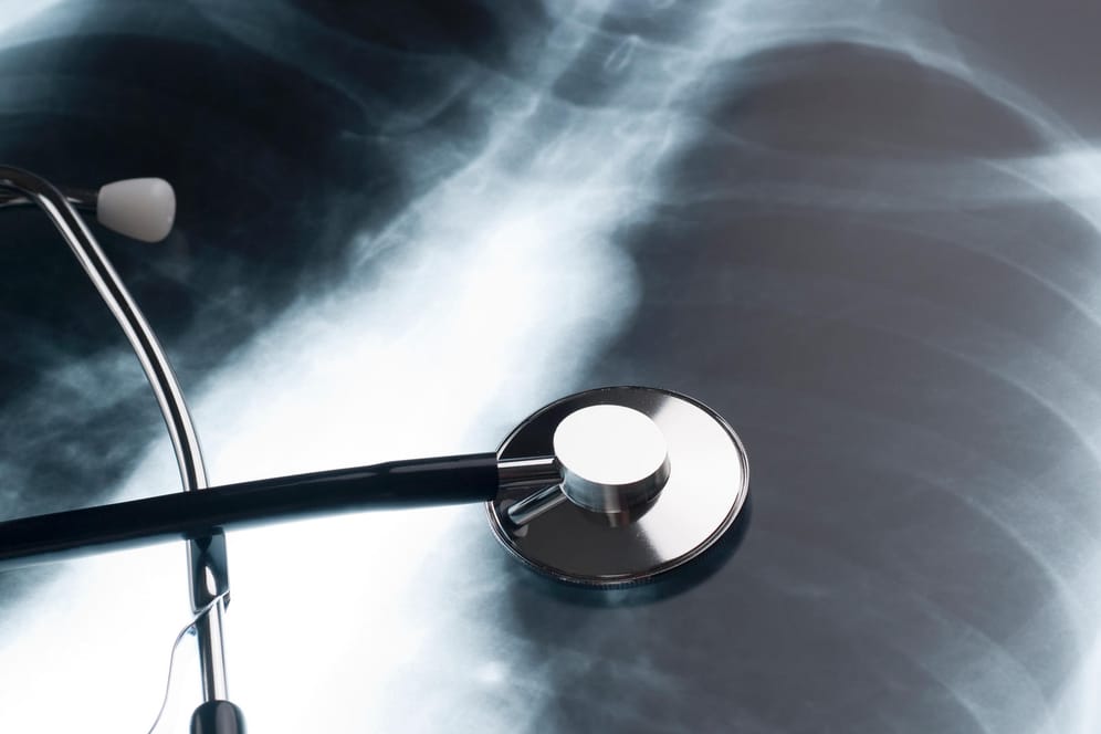 Ein Stethoskop liegt auf einem Röntgenbild: Die meisten Knochentumore werden mithilfe bildgebender Verfahren diagnostiziert.