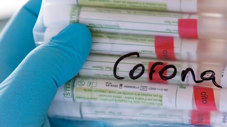 Coronavirus - Test