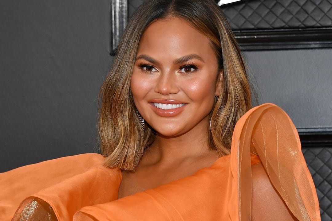 Chrissy Teigen: Das Model ließ sich seine Brustimplantate entfernen.