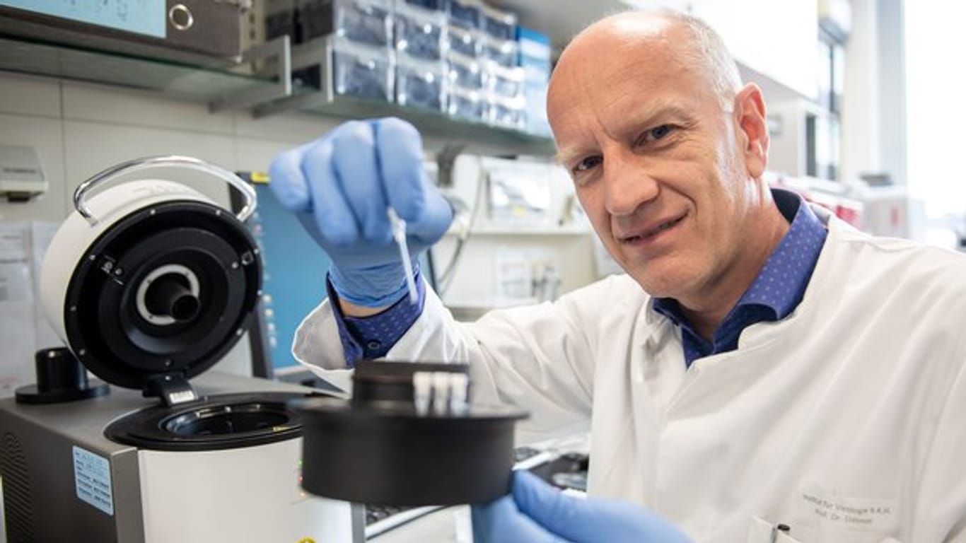 Laut Ulf Dittmer, Leiter des Instituts für Virologie der Universitätsklinik, könnte sich die Anzahl der Abwehrzellen bei Covid-19-Patienten auf den Verlauf der Erkrankung auswirken.