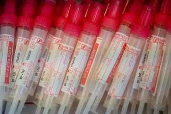 Proberöhren für die Blutentnahme liegen in einer Verpackung